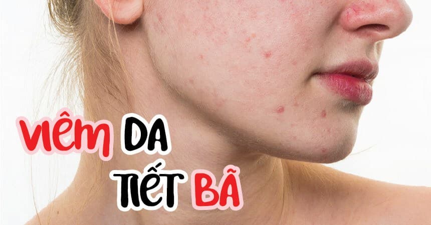 Thải Độc Tố Chuyên Sâu